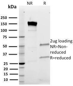 SDS-PAGE analysis of Anti-Band 3 Antibody [Q1/156] under non-reduced and reduced conditions; showing intact IgG and intact heavy and light chains, respectively. SDS-PAGE analysis confirms the integrity and purity of the antibody