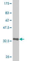 Anti-ZSCAN21 Mouse Monoclonal Antibody [clone: 4F10]