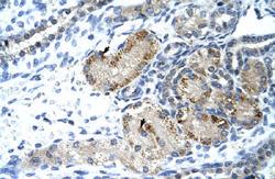 Anti-GTF2IRD1 Rabbit Polyclonal Antibody