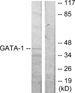 Western blot analysis of lysates from COS7 cells using Anti-GATA1 Antibody. The right hand lane represents a negative control, where the antibody is blocked by the immunising peptide