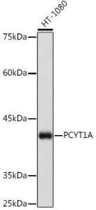 Western blot analysis of extracts of K-562 cells, using Anti-CT A Antibody [ARC2098] (A305693) at 1:1,000 dilution The secondary antibody was Goat Anti-Rabbit IgG H&L Antibody (HRP) at 1:10,000 dilution Lysates/proteins were present at 25 µg per lane