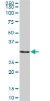 Anti-SULT1A3 Mouse Polyclonal Antibody