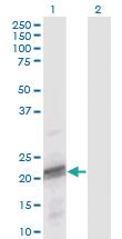 Anti-ODAM Mouse Monoclonal Antibody [clone: 2F8]