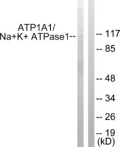 Western blot analysis of lysates from HeLa cells using Anti-alpha 1 Sodium Potassium ATPase Antibody. The right hand lane represents a negative control, where the antibody is blocked by the immunising peptide