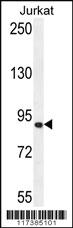 Anti-XRCC5 Rabbit Polyclonal Antibody