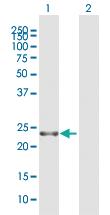 Anti-RTN3 Mouse Polyclonal Antibody