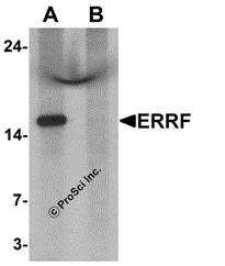 Western blot analysis of ERRF in HeLa cell lysate with ERRF antibody at 1 &#956;g/mL in (A) the absence and (B) the presence of blocking peptide.