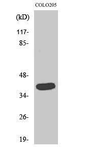 Western blot analysis of various cells using Anti-GATA1 Antibody