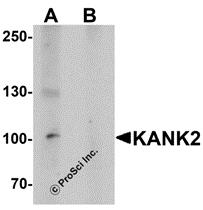 Western blot analysis of KANK2 in mouse brain tissue lysate with KANK2 antibody at 1 &#956;g/mL in (A) the absence and (B) the presence of blocking peptide.