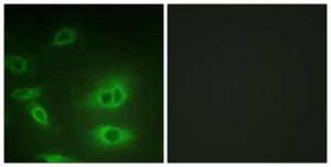 Immunofluorescence analysis of HeLa cells using Anti-alpha 1 Sodium Potassium ATPase Antibody. The right hand panel represents a negative control, where the antibody was pre-incubated with the immunising peptide