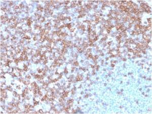 Anti-CD43 antibody