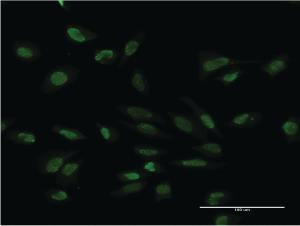 Anti-PMS2 Mouse Monoclonal Antibody [clone: 4D11]