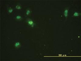 Anti-CDK13 Mouse Monoclonal Antibody [clone: 1B3-1B11]