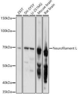 Western blot analysis of extracts of various cell lines, using Anti-68kDa Neurofilament/NF-L Antibody (A12580) at 1:1,000 dilution The secondary antibody was Goat Anti-Rabbit IgG H&L Antibody (HRP) at 1:10,000 dilution Lysates/proteins were present at 25 µg per lane