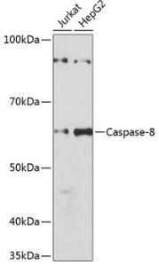 Western blot analysis of extracts of various cell lines, using Anti-Caspase-8 Antibody [ARC0028] (A305694) at 1:1,000 dilution The secondary antibody was Goat Anti-Rabbit IgG H&L Antibody (HRP) at 1:10,000 dilution Lysates/proteins were present at 25 µg per lane