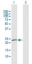 Anti-RTN3 Rabbit Polyclonal Antibody