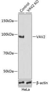 Western blot analysis of extracts from normal (control) and VAV2 knockout (KO) HeLa cells, using Anti-VAV2 Antibody (A308208) at 1:3,000 dilution. The secondary antibody was Goat Anti-Rabbit IgG H&L Antibody (HRP) at 1:10,000 dilution.