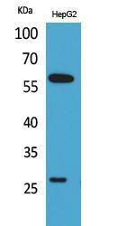 Western blot analysis of HepG2 cells using Anti-GGT1 Antibody