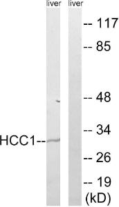 Western blot analysis of lysates from mouse liver using Anti-HCC1 Antibody. The right hand lane represents a negative control, where the antibody is blocked by the immunising peptide.