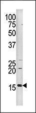 Anti-HIST3H3 Rabbit Polyclonal Antibody (Biotin)