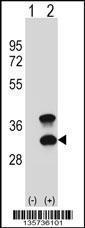 Anti-CD79B Rabbit Polyclonal Antibody (FITC (Fluorescein Isothiocyanate))