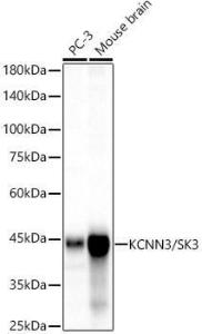 Western blot analysis of various lysates, using Anti-KCNN3 / SK3 Antibody [ARC60792] (A309697) at 1:2000 dilution