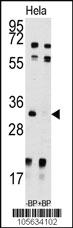 Anti-UCK2 Rabbit Polyclonal Antibody