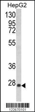 Anti-GSTA1 Rabbit Polyclonal Antibody