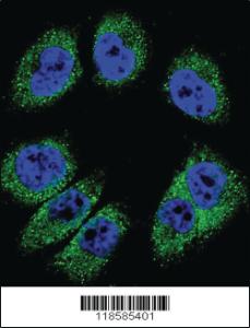 Anti-POSTN Rabbit Polyclonal Antibody