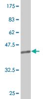 Anti-TGIF2 Mouse Monoclonal Antibody [clone: 2F3]