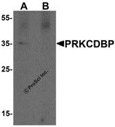 Western blot analysis of PRKCDBP in A20 cell lysate with PRKCDBP antibody at 1 µg/ml in (A) the absence and (B) the presence of blocking peptide.