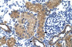 Anti-GTF3C5 Rabbit Polyclonal Antibody