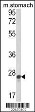 Anti-GSTA1 Rabbit Polyclonal Antibody