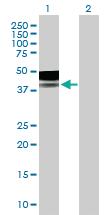 Anti-PLA2G15 Mouse Polyclonal Antibody