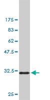 Anti-PAK1 Mouse Monoclonal Antibody [clone: 4D1]