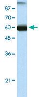 Anti-GTF3C5 Rabbit Polyclonal Antibody