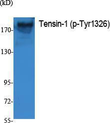 Western blot analysis of extracts from K562 cells using Anti-Tensin-1 (phospho Tyr1326) Antibody