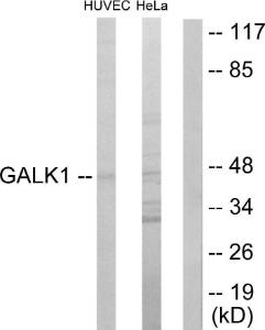 Western blot analysis of lysates from HUVEC and HeLa cells using Anti-GALK1 Antibody. The right hand lane represents a negative control, where the antibody is blocked by the immunising peptide