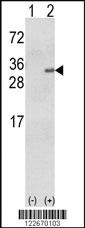 Anti-GSTA1 Rabbit Polyclonal Antibody