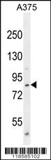 Anti-POSTN Rabbit Polyclonal Antibody