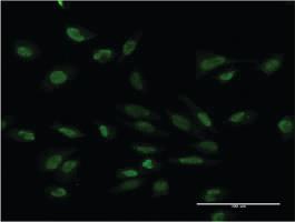 Anti-PMS2 Mouse Monoclonal Antibody [clone: 4D11]