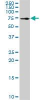 Anti-SSH6 Rabbit Polyclonal Antibody