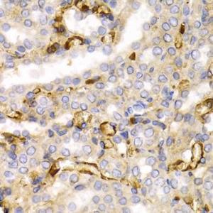 Immunohistochemistry analysis of paraffin-embedded rat kidney using Anti-68kDa Neurofilament/NF-L Antibody (A12580) at a dilution of 1:200 (40x lens) Perform microwave antigen retrieval with 10 mM PBS buffer pH 72 before commencing with IHC staining protocol