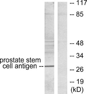 Western blot analysis of lysates from HepG2 cells using Anti-Prostate Stem Cell Antigen Antibody. The right hand lane represents a negative control, where the antibody is blocked by the immunising peptide