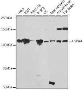 Western blot analysis of extracts of various cell lines, using Anti-HSPA4 Antibody [ARC2237] (A305695) at 1:1,000 dilution. The secondary antibody was Goat Anti-Rabbit IgG H&L Antibody (HRP) at 1:10,000 dilution.