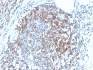 Immunohistochemical analysis of formalin-fixed, paraffin-embedded human tonsil using Anti-CD6 Antibody [C6/2884R]