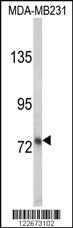 Anti-LTF Rabbit Polyclonal Antibody