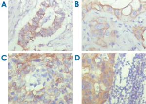 Anti-ALCAM Mouse Monoclonal Antibody [clone: 10F1G12]