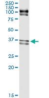 Anti-ELAVL1 Polyclonal Antibody Pair