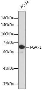 Western blot analysis of extracts of PC-12 cells, using Anti-RACGAP1/MGCRACGAP Antibody [ARC2394] (A307175) at 1:1000 dilution. The secondary Antibody was Goat Anti-Rabbit IgG H&L Antibody (HRP) at 1:10000 dilution. Lysates/proteins were present at 25 µg per lane